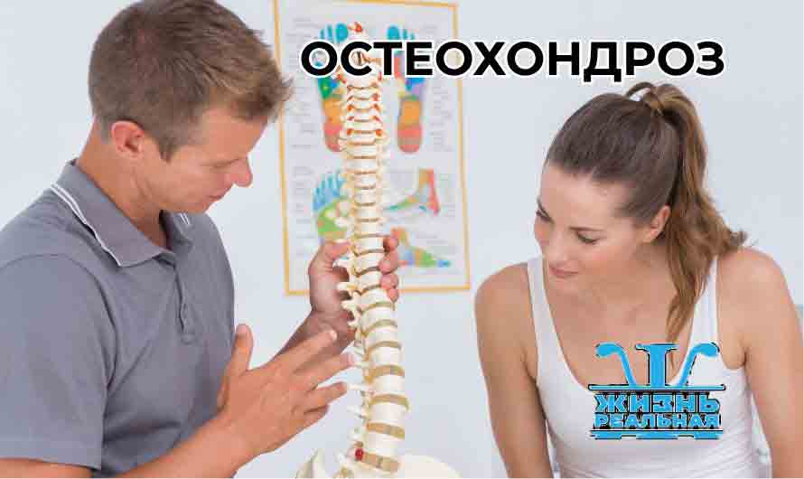 Остеохондроз, как постоянный недуг